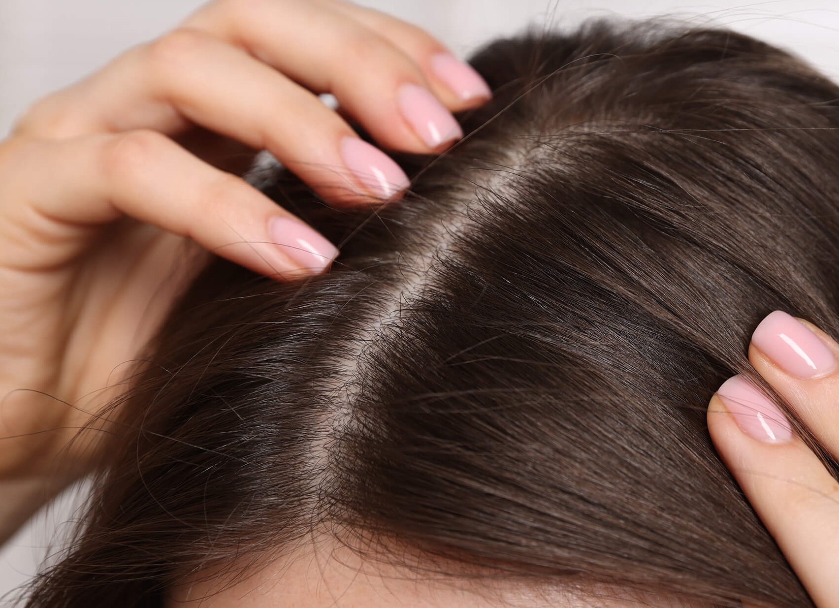 Почему возникают заболевания кожи головы?