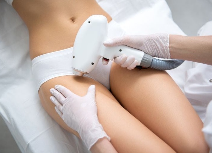 Как подготовиться к лазерной эпиляции глубокого бикини в первый раз