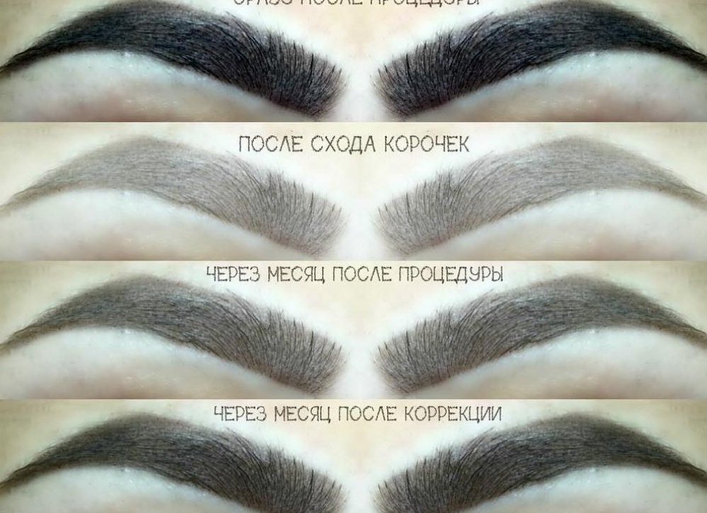Как заживают брови после перманентного макияжа (татуажа) по дням
