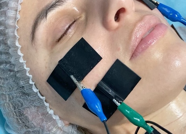 Миостимуляция лица: что это и как работает процедура миолифтинга